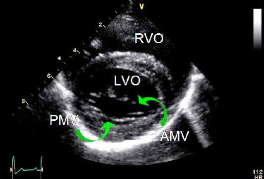 Right parasternal short axis mitral valve level Obtained from the right side Evaluate left ventricular wall thickness Evaluate left ventricular wall motion Evaluate mitral valve morphology and