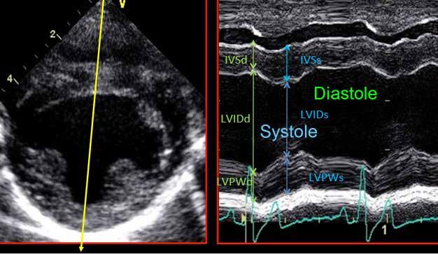 Standard M-mode echocardiographic views M-mode left ventricular papillary muscle level Obtained from the right-sided short-axis or long-axis views Evaluate left ventricular wall thickness and