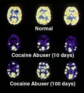 and it must be repeated The thing that drugs of abuse have in common is they stimulate the reward pathway, tricking us into thinking we did something