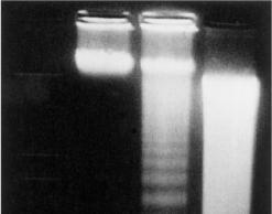 Assays for Apoptosis 2. DNA Fragmentation. 1. Laddering Technique. Endonuclease cleavage product on agarose gel. 2. TUNEL (Terminal dutp Nick End-Labeling).