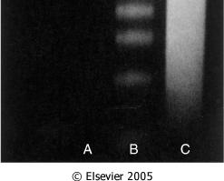 Sensitive and fast, but false positives from oncotic cells and cells in DNA repair and gene transcription. Agarose gel electrophoresis for apoptosis.