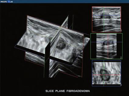 You can display MPRs (multiplanar reconstructions) and 2D images from the volume set.