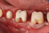 underlying periodontal foundation.
