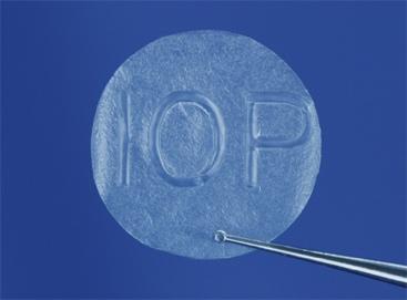 AmbioDisk AmbioDisk Amniotic Membrane from IOP Ophthalmics AmbioDisk is a 4th generation amniotic membrane (AM) technology - a sutureless, overlay AM disk for the office-based or surgical treatment