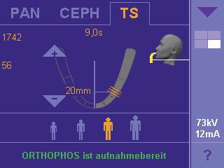 the patient s head. Optimize the procedures in your practice. With ORTHOPHOS XG Plus and TSA you can give a motivated patient an instant answer about the feasibility of an implant treatment.