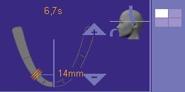 Standard preset values are entered in order to capture the exposure of the specific area of the first, second or third tooth precisely. 1.