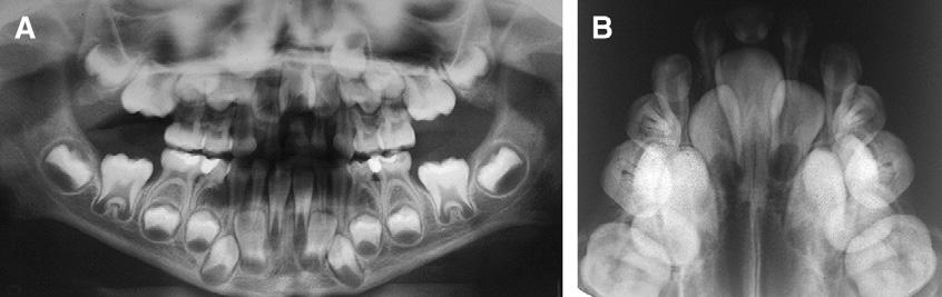 American Journal of Orthodontics and Dentofacial Orthopedics Bolan et al 495 Volume 138, Number 4 Fig 3.