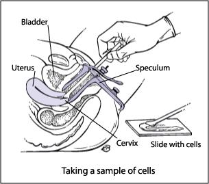 1. Performing a vaginal speculum exam during which a health care provider
