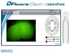 Fluorescence Methods Quantitative Light Induced Fluorescence