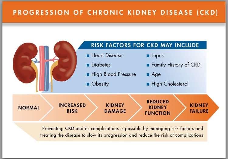 Progression and Stages of Chronic Kidney Disease Property of