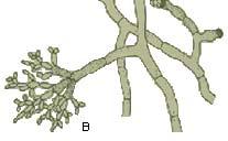structures do you see? A. Acrotheca B.