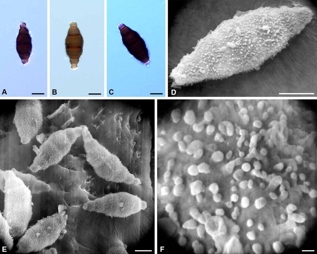 Studies in genera similar to Torula Fig. 9. Bahusandhika rhombica (holotype). A C. Mature conidia. D F. SEM micrographs of conidia and verrucae. Bars: A E = 10 µm, F = 1 µm.