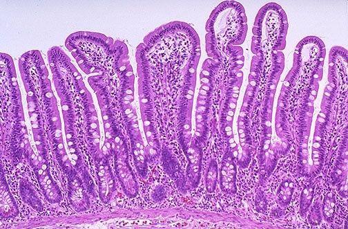 4. The small intestine contains structures known as villi.