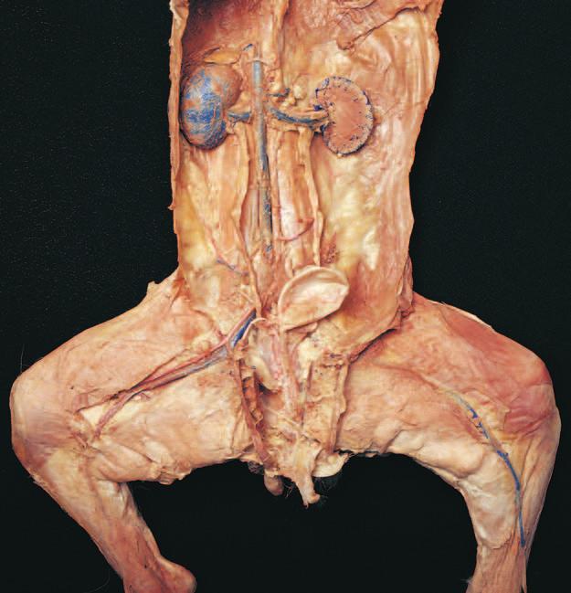 with testis Epididymis Penis Left kidney (sectioned) Left ureter Vas deferens Urinary bladder Inguinal