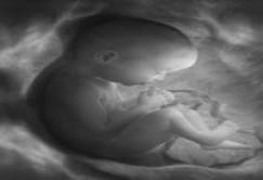 fetus 1 umbilical cord 4 9 month old fetus 2 2.