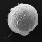 ovaries uterus sperm fallopian tubes penis fertilises Male