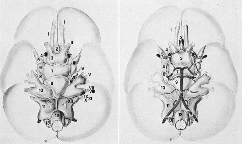 Anatomical observations of subarachnoid cisterns 2. the ninth, 10th, l lth the 12th cranial nerves; 3. the lateral medullary postolivary veins; 4. the choroid plexus.