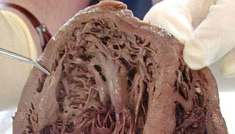 It carries oxygen rich blood from the left ventricle of the heart to the body.