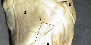Right Auricle 2.