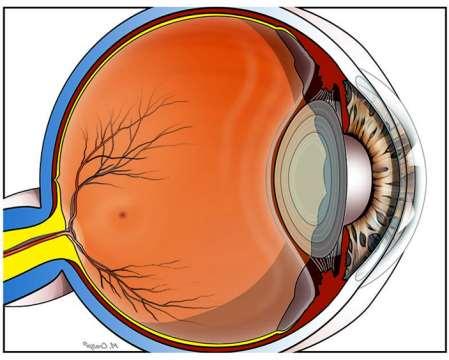 Optic nerve, optic nerve head, and retina Central nervous system Behind blood-brain barrier Susceptible to permanent loss Optic nerve Connects eye to brain Bathed in cerebrospinal fluid