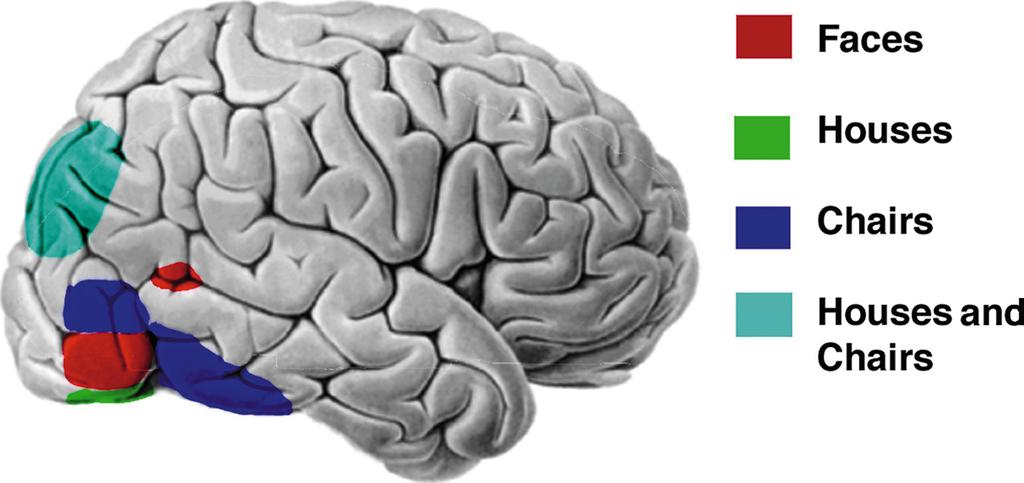 Shape Detection Specific combinations of temporal lobe activity occur as people