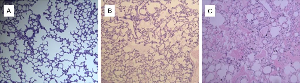 Figure 1. Histopathology of lung tissues in each group. A. Control group. B. Low tidal volume group. C. High tidal volume group. Shown were representative images of HE staining.