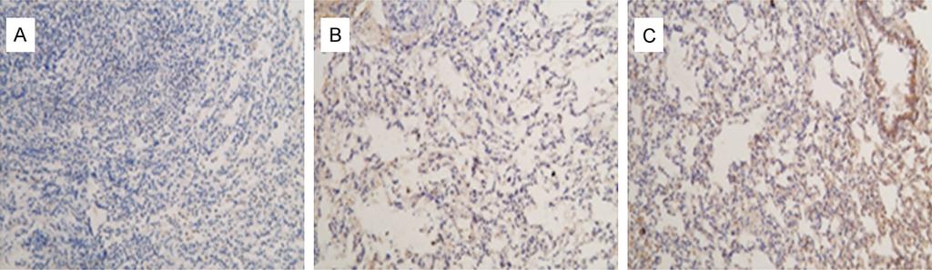 C. High tidal volume group. Shown were representative images of TNF-α staining. Magnification fold: 200. Table 3.