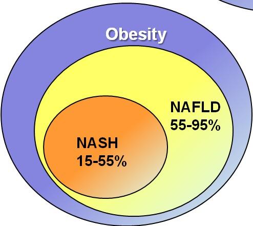 Prevalence of NAFLD and NASH in high-risk groups Obesity: 1 billion subjects