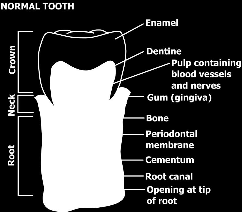 And, clinically crown is the part which is referred to any of the tooth which is invisible in the mouth. The crown of the tooth has many ridges on its top surface to aid in the chewing of food.