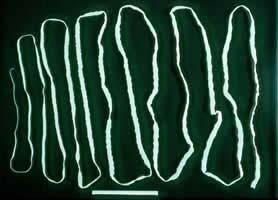Taenia saginata The beef tapeworm, Taenia saginata, causes taeniasis in humans through the ingestion of raw or poorly cooked meat of infected cows.