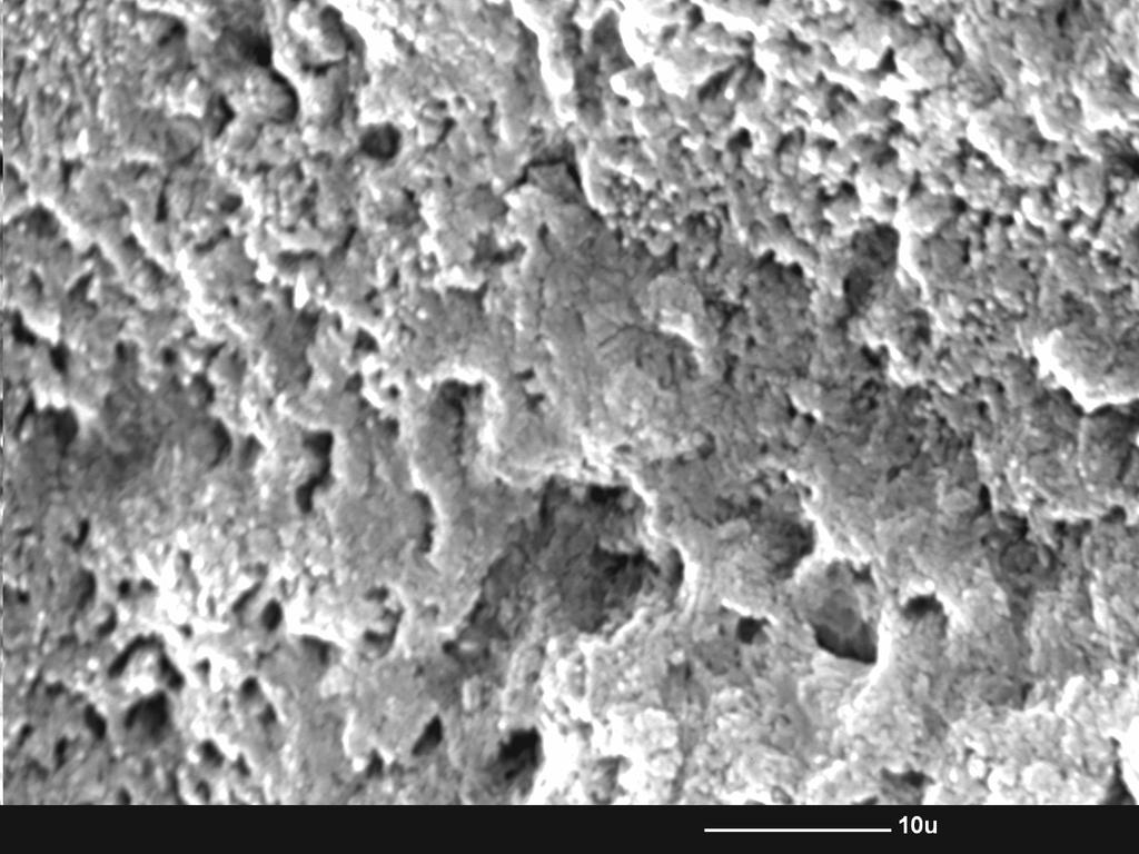 Figure 4 The SEM micrograph of enamel surface of a tooth sample treated with Opalescence 15% PF for 8 hours.
