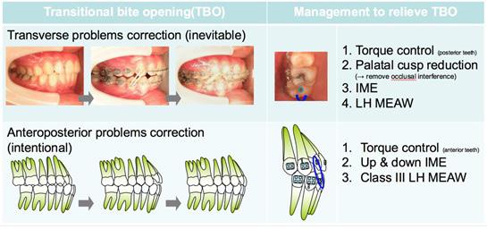 In some situations, bite opening is inevitable (eg, during posterior buccal crossbite correction). However, in others, bite opening is intentional procedure (eg, during anterior crossbite correction).