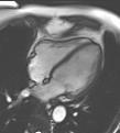 3 Most Common Cardiac Imaging Planes 2