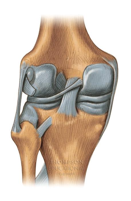 The Knee Joint Posterior (deep) Femur Anterior cruciate Posterior meniscofemoral Medial meniscus Popliteal