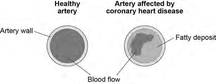 4 The coronary arteries supply blood to the heart. Figure 2 shows two coronary arteries. Figure 2 0 1.