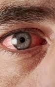 Clinical Signs Red eyes Dry mouth Nystagmus Anxiety Increased appetite Impaired motor