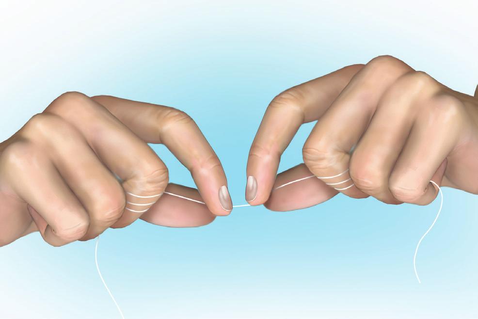 fingers. Use the thumbs to direct floss between contacts of the upper teeth.