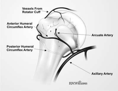 Općenito, frakture proksimalnog humerusa možemo uspoređivati s frakturama proksimalnog femura.