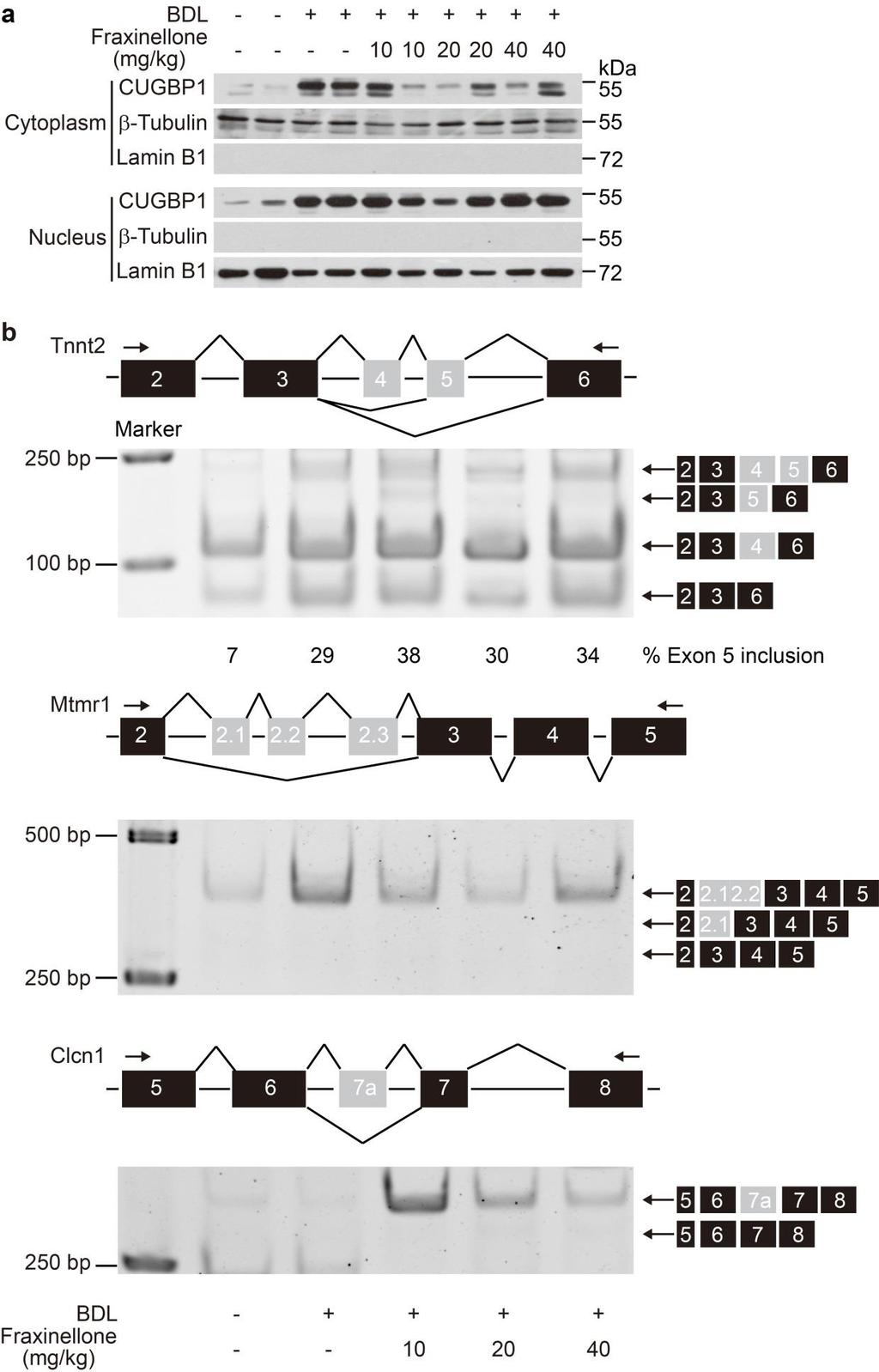 Supplementary Figure 5. Splicing pattern of CUGBP1 related genes in fibrotic liver.