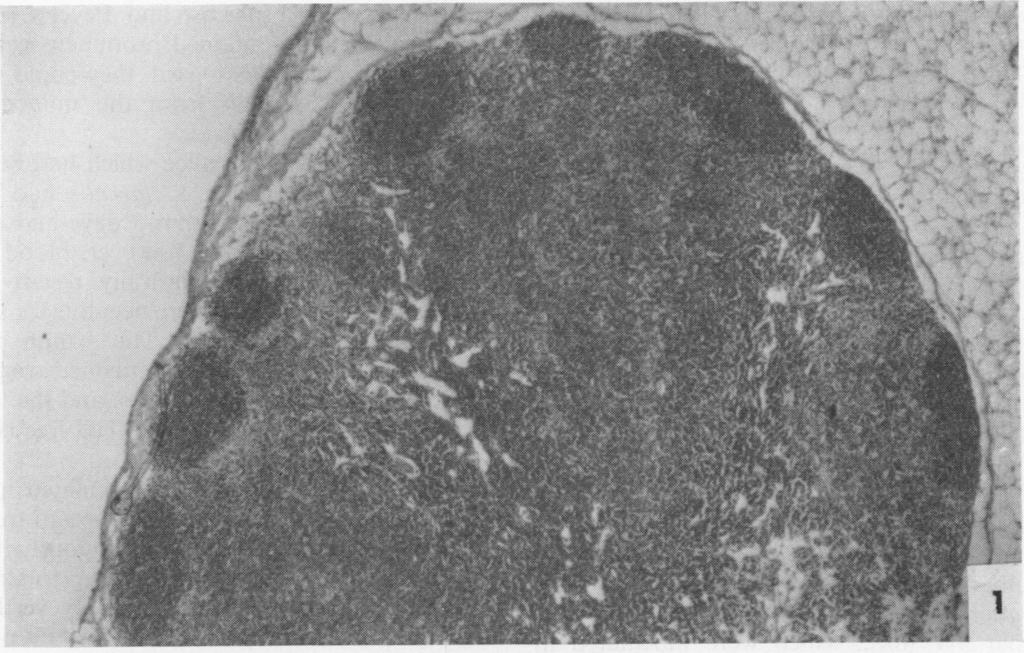 rre > VOL. 2, 1970 RESPONSES OF PEYER'S PATCHES 97 The tissues examined from each mouse, including ined by conventional microscopy.