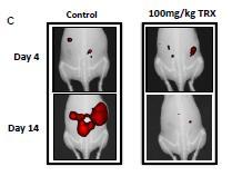 Cantrixil (TRXE-002-1) SBP First-in-class agent that degrades the tumor-initiating cells thought responsible for tumor recurrence after chemotherapy Single agent activity in PDX models of ovarian