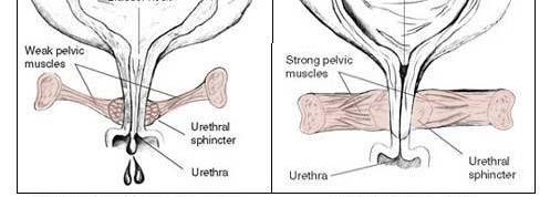 lies below prostate and pierces the pelvic floor muscles Distal (conduit) Prostate Gland Small,