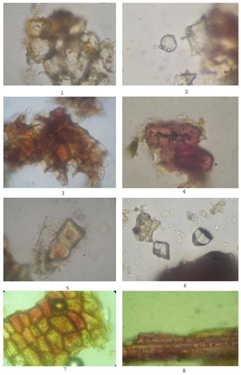 Powder microscopy of stem bark: Organoleptic characters are shown in [Table-1].