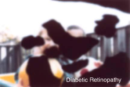 Diabetes Retinal Examination Every 12