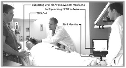 TMS and Postoperative Pain One rtms Session Cuts Cumulative Morphine Use by 40% TMS half-life?