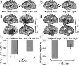 Differences in Resting State Functional Connectivity between More Effective vs Less Effective DLPFC Stimulation Sites Prefrontal TMS Induces Dopamine Release in Ipsilateral Caudate 15 10