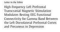 TMS Modulates EEG Gamma Frequency in Distributed Brain Regions Treatment with TMS Therapy is associated with an enhancement of gamma band activity in DLPFC and anticorrelated reduction of activity in