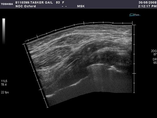 Ultrasound Initial imaging