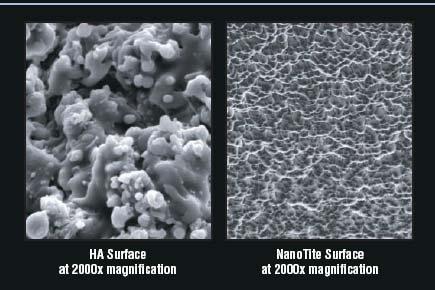 Biomet NanoTite Implant OSSEOTITE Surface Images Source: BioMet.