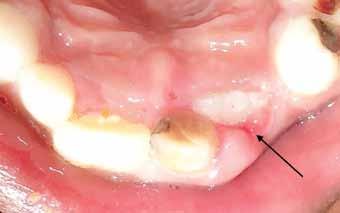 Case 2 An 8-year-old boy was reported to the department of pediatric dentistry with the chief complaint of a funny looking small